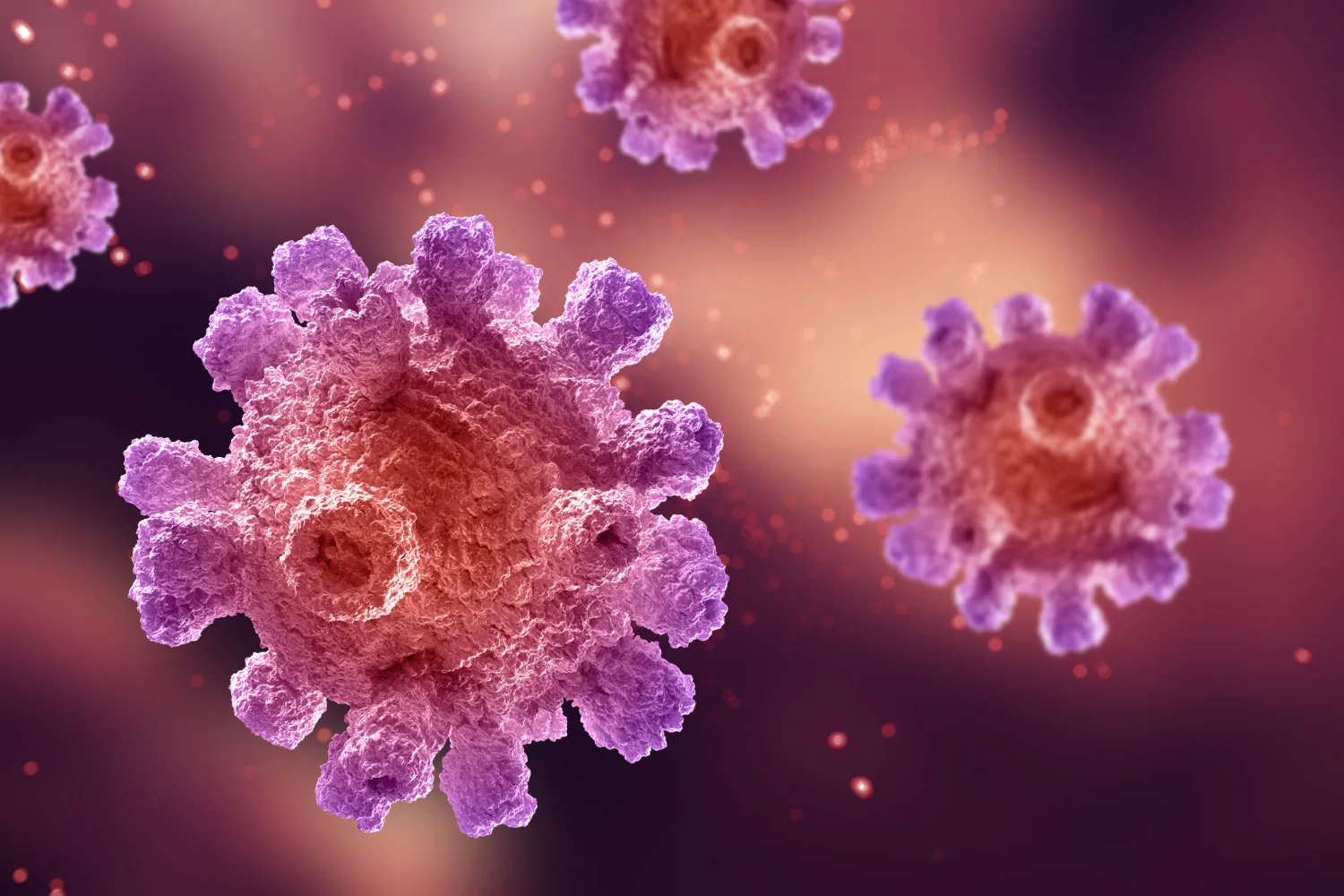 Diagnóstico y tratamiento de las lesiones causadas por el virus de papiloma humano